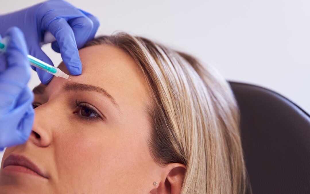 Botox for Migraine Relief: What Patients Need to Know